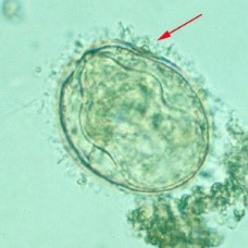 Huevo de Schistosoma mekongi. CDC Public Health Image Library (PHIL).                                                                                                      