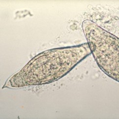 Huevos de Schistosoma intercalatum. DPDx - Laboratory Identification of Parasites of Public Health Concern.                                                                                       