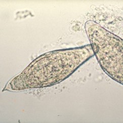 Huevos de Schistosoma intercalatum. DPDx - Laboratory Identification of Parasites of Public Health Concern 