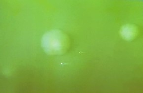 Colonia de M. bovis. CDC Public Health Image Library (PHIL).