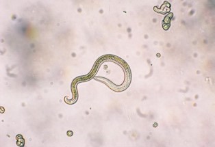  Larva de Toxocara canis.                       
