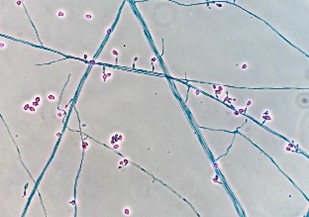 Lomentospora prolificans