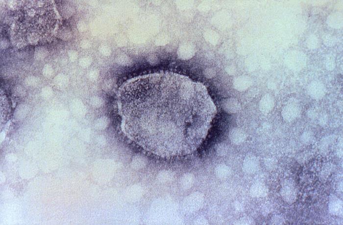 Virión de Arenavirus. CDC Public Health Image Library (PHIL). ​​​​​​​
