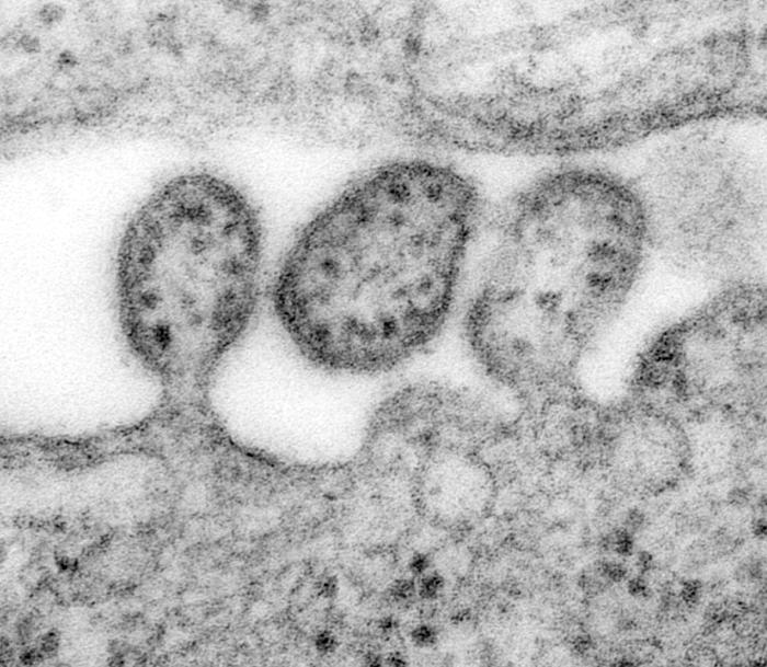 Viriones de Mamarenavirus de Lassa. CDC Public Health Image Library (PHIL). 