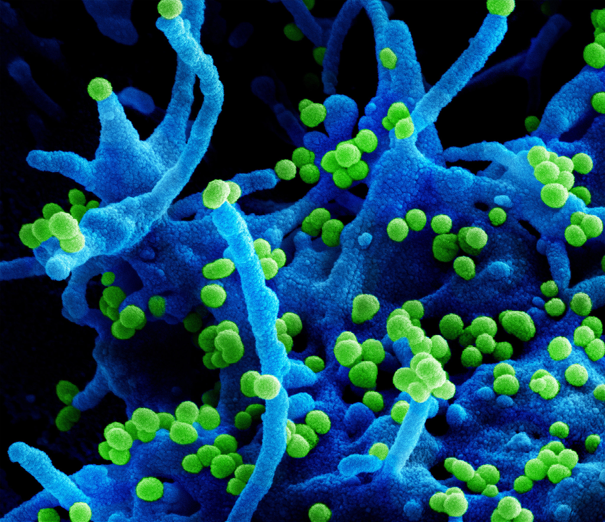 Micrografía electrónica de barrido del Mamarenavirus de Lassa. National Institute of Allergy and Infectious Diseases (NIAID). 
