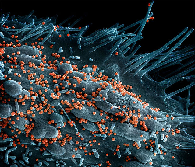 Imagen de Arenavirus del Viejo Mundo (Mamarenavirus de Lassa) National Institute of Allergy and Infectious Diseases (NIAID).