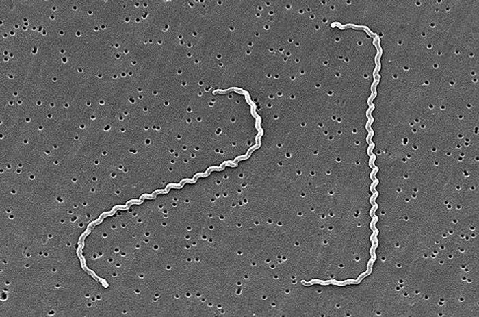 Leptospira interrogans. CDC Public Health Image Library (PHIL).