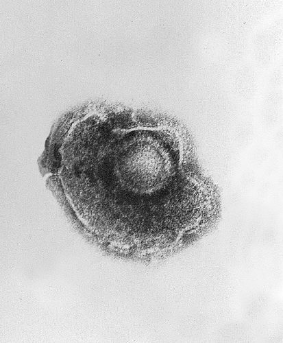 Herpesvirus varicella-zoster. CDC Public Health Image Library (PHIL).