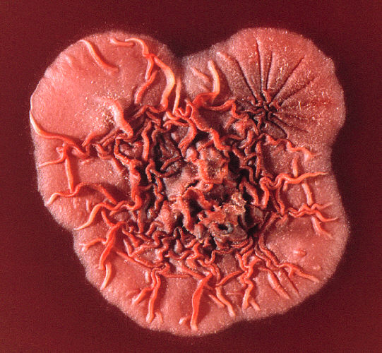 Colonia de P. marneffei. CDC Public Health Image Library (PHIL).