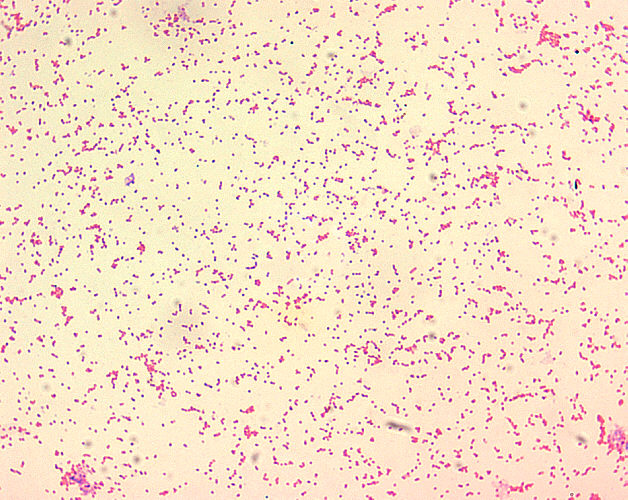 Cocobacilos de Brucella spp. CDC Public Health Image Library (PHIL).