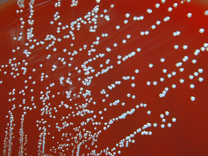 Colonias de B. melitensis. CDC Public Health Image Library (PHIL).