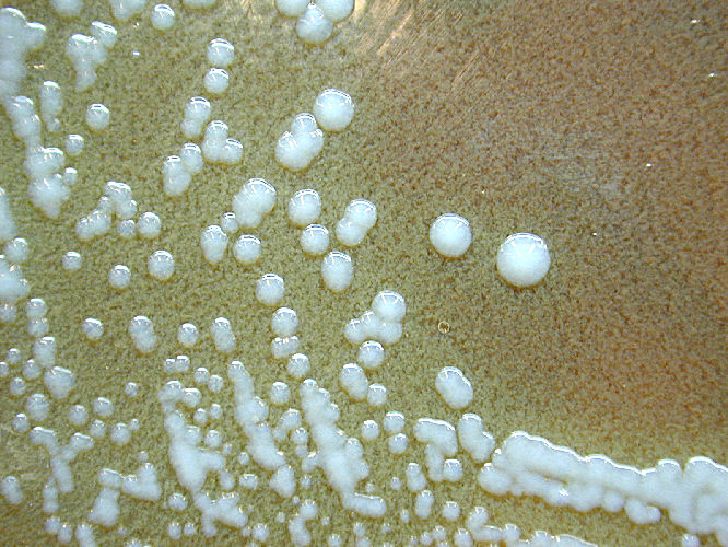 Colonias de Francisella tularensis. CDC Public Health Image Library (PHIL).