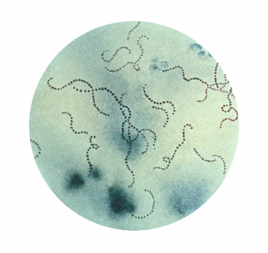 Streptococcus pyogenes. CDC Public Health Image Library (PHIL).