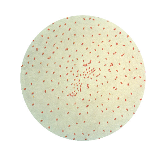 B. Pertussis. CDC Public Health Image Library (PHIL). 