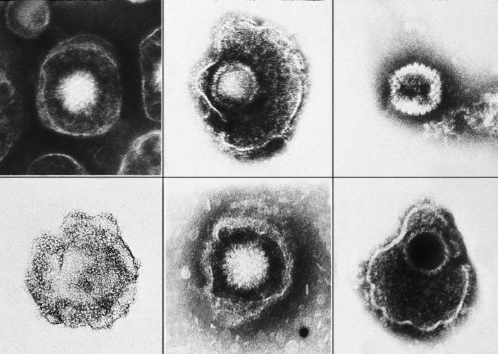 Varios virus de la familia Herpesviridae. CDC Public Health Image Library (PHIL).