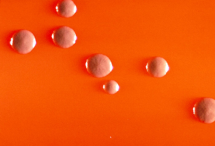 Colonias de Corynebacterium diphtheriae subsp. gravis.