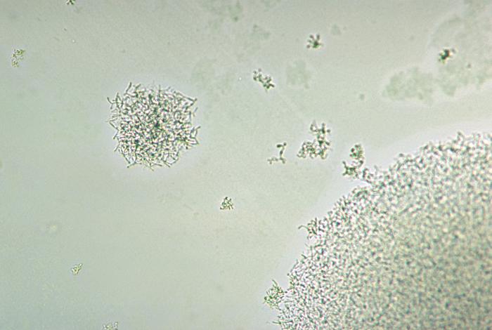 Colonias de Corynebacterium matruchotii. CDC Public Health Image Library (PHIL).