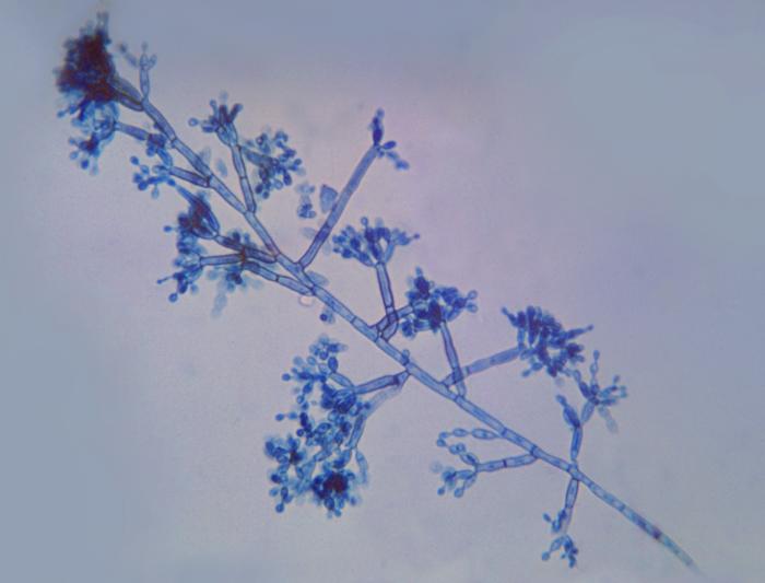 Fonsecaea pedrosoi. CDC Public Health Image Library (PHIL).