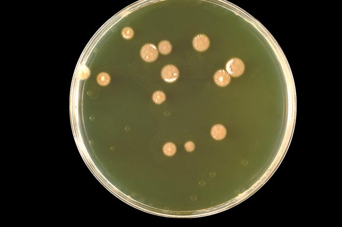 Colonia de Histoplasma capsulatum. CDC Public Health Image Library (PHIL).