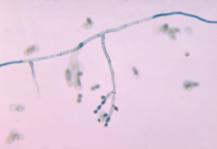 Cladosporium spp.  CDC Public Health Image Library (PHIL).
