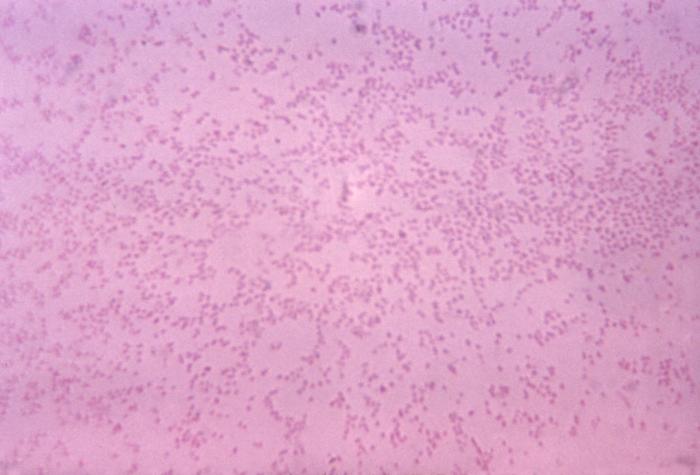 Pasteurella multocida. CDC Public Health Image Library (PHIL).
