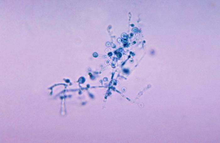 B. dermatitidis. CDC Public Health Image Library (PHIL).