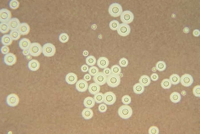 C. neoformans var. neoformans. CDC Public Health Image Library (PHIL). 