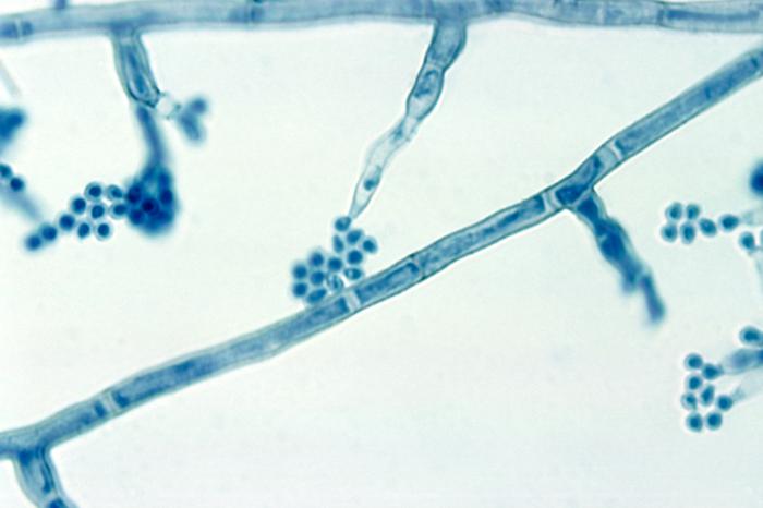 Fiálides con conidios terminales de Madurella mycetomatis. CDC Public Health Image Library (PHIL).