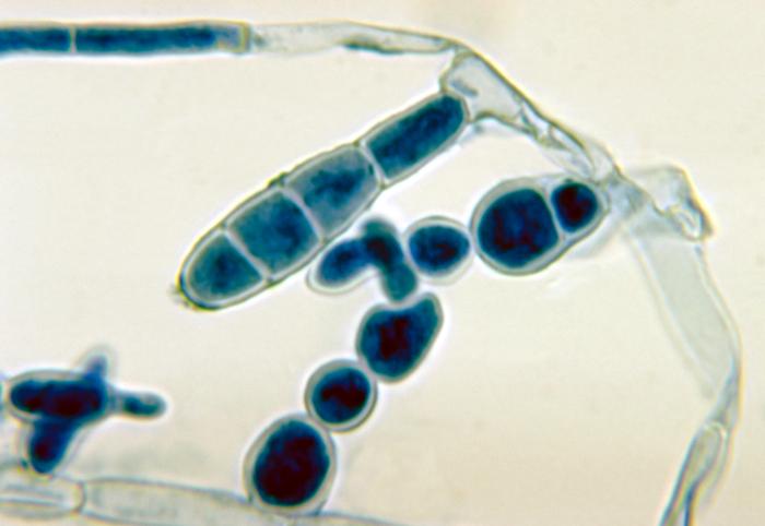 E. floccosum. CDC Public Health Image Library (PHIL)