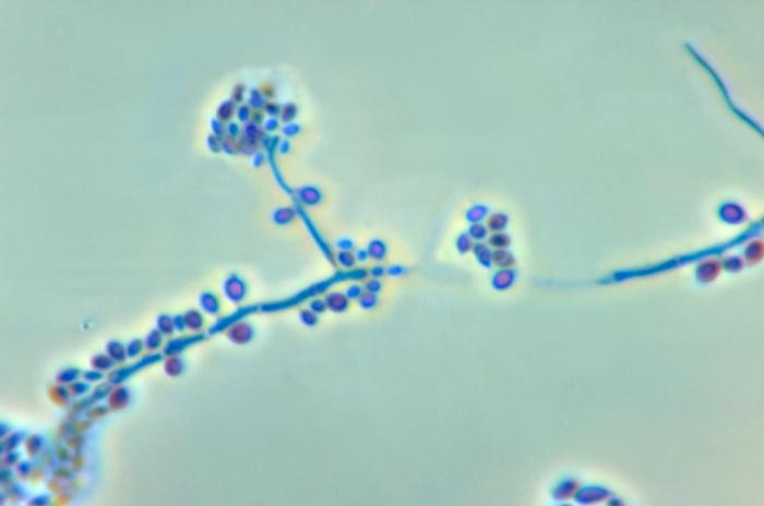 Sporothrix schenckii. CDC Public Health Image Library (PHIL).