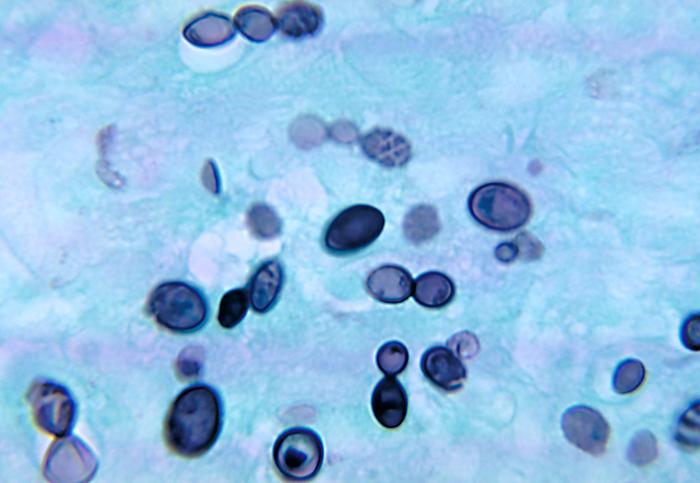 Histoplasma duboisii. CDC Public Health Image Library (PHIL).