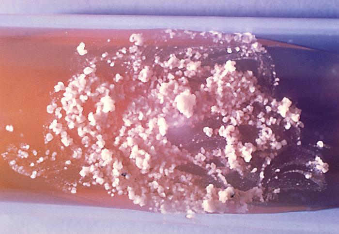 Cultivo en forma de levadura P. brasiliensis. CDC Public Health Image Library (PHIL).