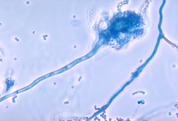 Conidióforos de A. fumigatus. CDC Public Health Image Library (PHIL).  