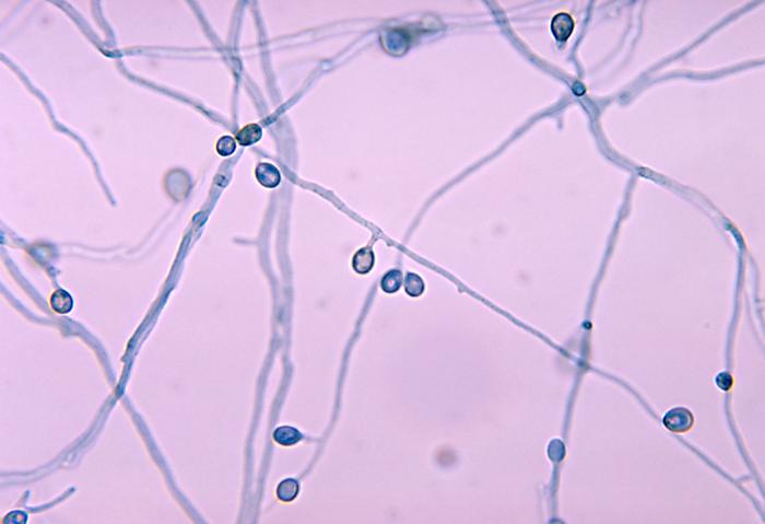 Pseudallescheria boydii. 