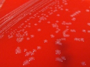 Pasteurella multocida