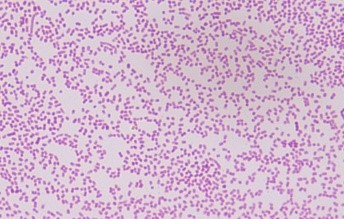 Tinción de Gram de Pasteurella multocida