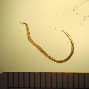 Larva L3 de Anisakis. DPDx – Laboratory Identification of Parasitic Diseases of Public Health Concern