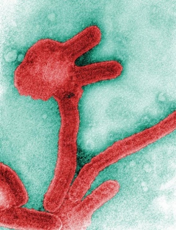 Virus de Marburgo. CDC Public Health Image Library (PHIL).