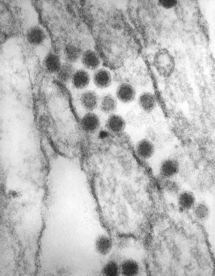 Imagen obtenida con microscopio electrónico de transmisión de viriones de Flavivirus. CDC Public Health Image Library (PHIL).