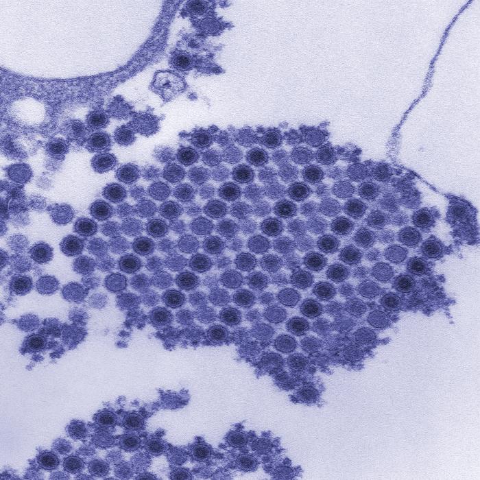 Viriones del virus del chikungunya por microscopía de transmisión electrónica. CDC Public Health Image Library (PHIL). 