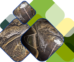 Informe de siniestralidad en el Sector del Metal