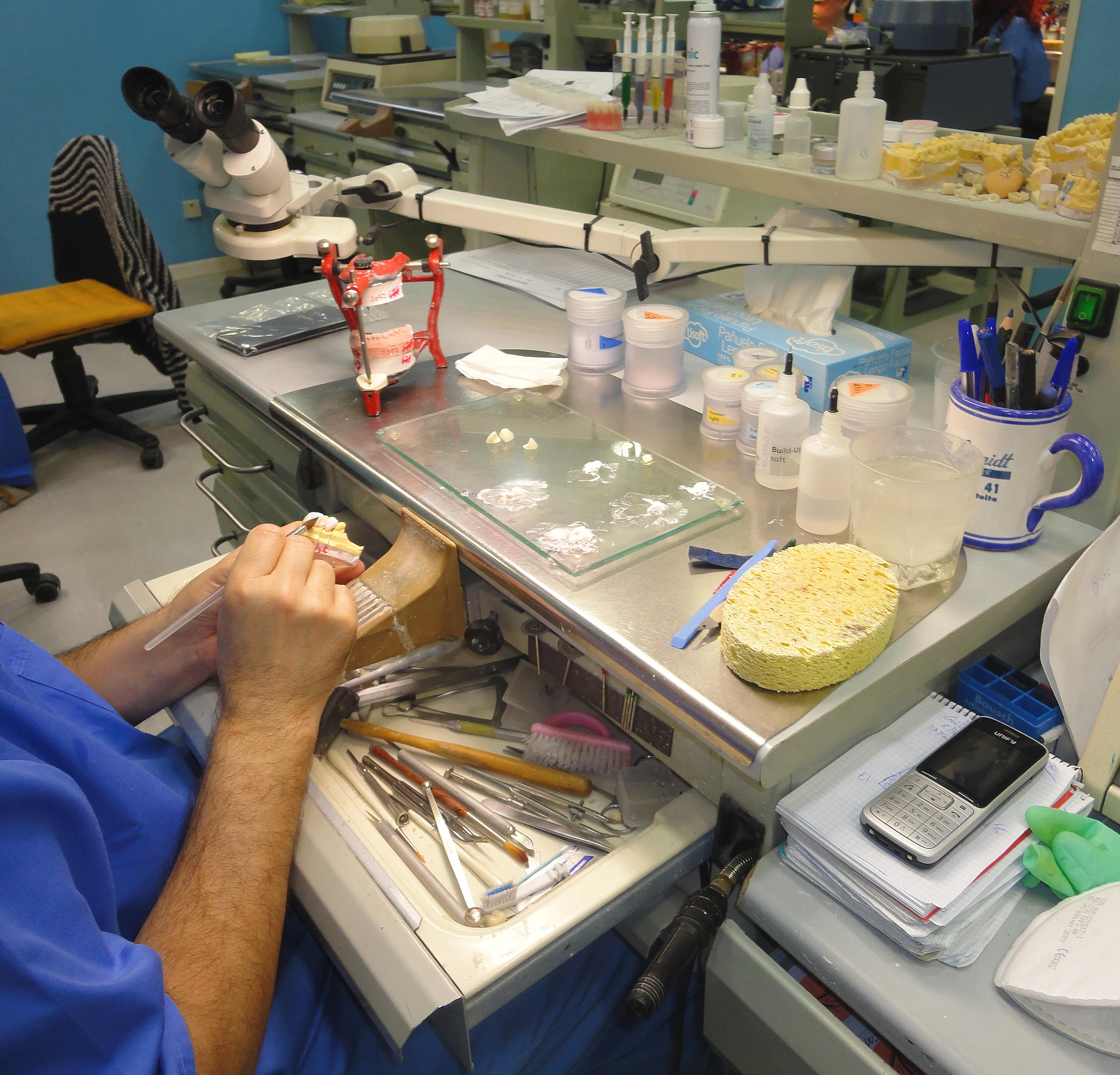 Figura 1: Montaje de dientes en prótesis de resina sobre modelo de cera