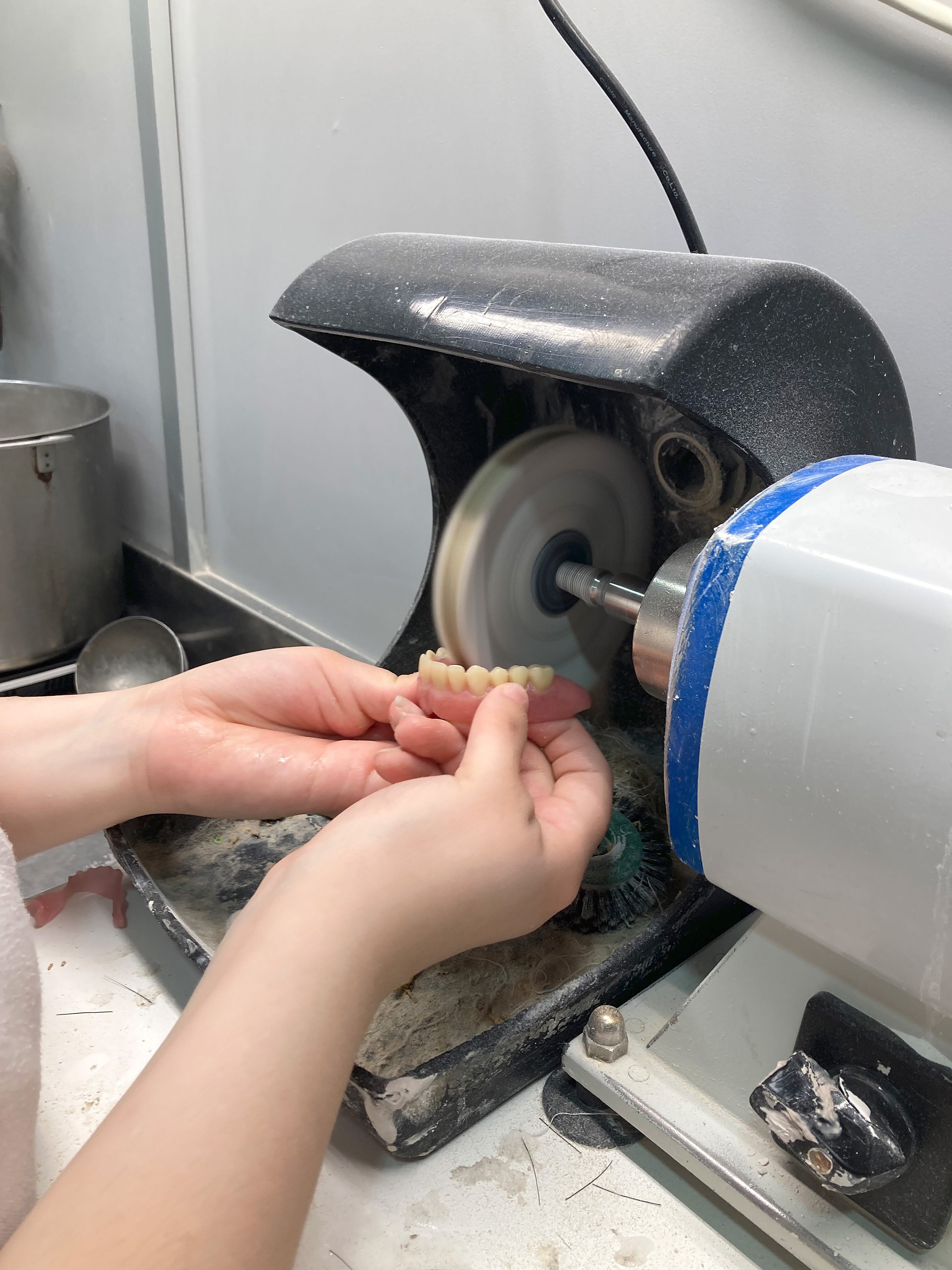 Figura 3: Actividad de pulido de prótesis