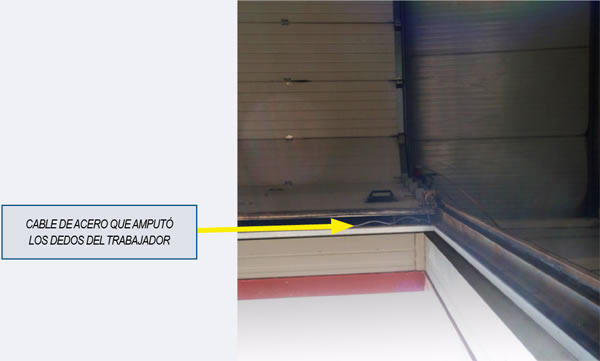 Cable de acero que amputó los dedos del trabajador