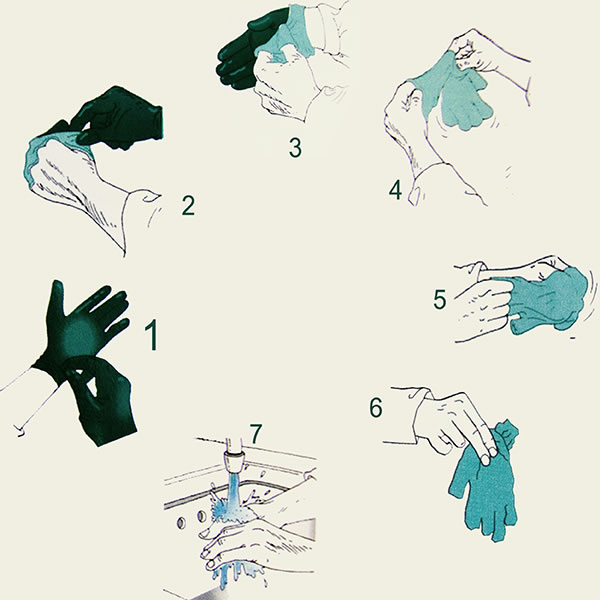 Aplicación del procedimiento para la retirada de los guantes